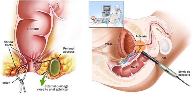 Treatment Options