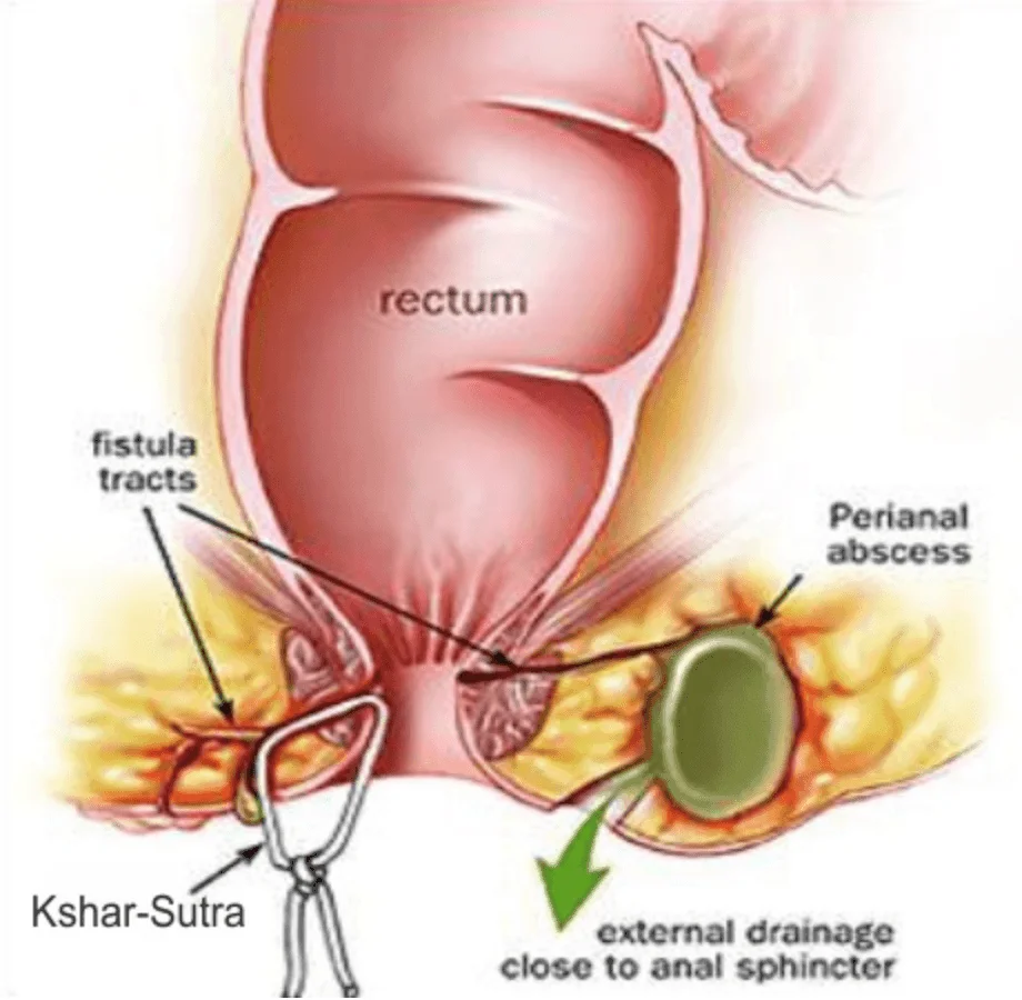 Treatment Options